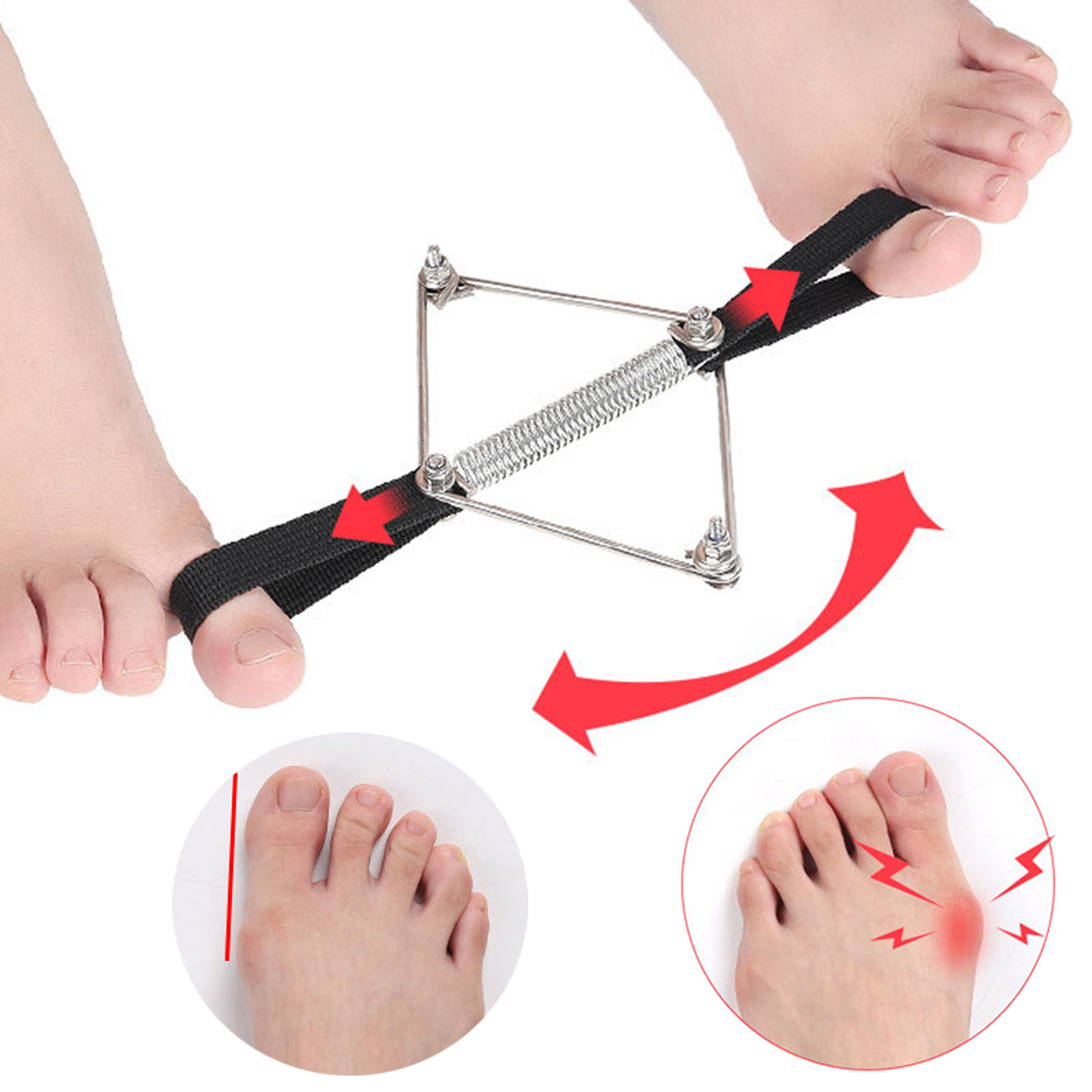 Correcteur d'oignon en nylon e - Pilates Yoga Wellness avis et prix